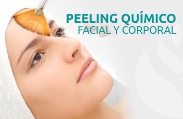 Peeling Quimico 100% online